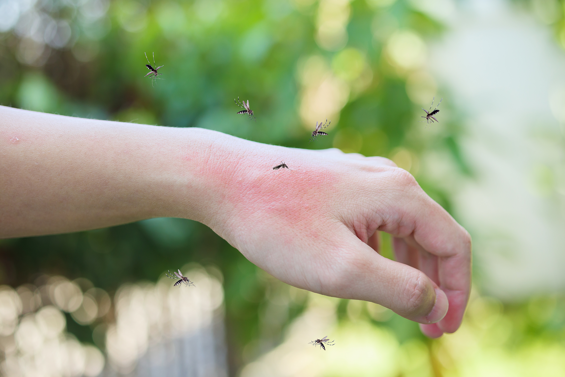 Picture associated with Mosquito and Tick Protection Services